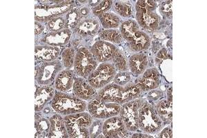 Immunohistochemical staining of human kidney with ARHGAP11A polyclonal antibody  shows moderate cytoplasmic and membranous positivity in tubular cells. (ARHGAP11A 抗体)