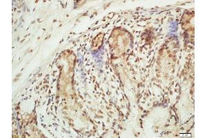 Formalin-fixed and paraffin embedded mouse intestine labeled with Rabbit Anti-RPA2(Thr21) Polyclonal Antibody, Unconjugated (ABIN713351) at 1:200 followed by conjugation to the secondary antibody and DAB staining (RPA2 抗体  (pThr21))