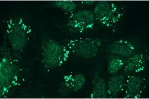 Immunocytochemistry (ICC) image for anti-Nephrosis 1, Congenital, Finnish Type (Nephrin) (NPHS1) antibody (ABIN870330) (Nephrin 抗体)