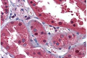 Human Kidney: Formalin-Fixed, Paraffin-Embedded (FFPE) (HINT1 抗体  (N-Term))