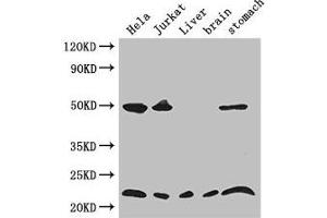 Western Blot Positive WB detected in: Hela whole cell lysate, Jurkat whole cell lysate, Mouse liver tissue, Mouse brain tissue, Mouse stomach tissue All lanes: COMMD1 antibody at 3. (COMMD1 抗体  (AA 2-190))