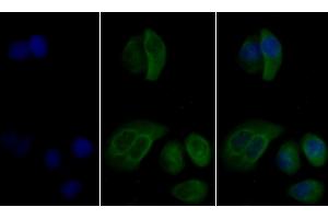 Immunohistochemistry (IHC) image for anti-Vimentin (VIM) antibody (ABIN7426163)