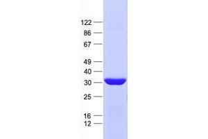 Western Blotting (WB) image for Zinc Finger Protein 124 (ZNF124) protein (His tag) (ABIN2735921)