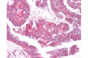 Immunohistochemistry (IHC) image for anti-Transient Receptor Potential Cation Channel, Subfamily M, Member 4 (TRPM4) (C-Term) antibody (ABIN1049434)