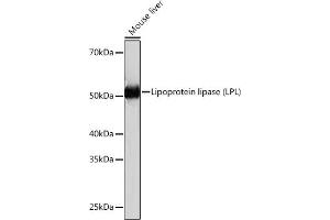 Western blot analysis of extracts of Mouse liver, using Lipoprotein lipase (LPL) (LPL) Rabbit mAb (ABIN1682726, ABIN3018558, ABIN3018559 and ABIN7101626) at 1:1000 dilution. (Lipoprotein Lipase 抗体)