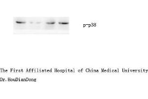Western Blot (WB) analysis: Please contact us for more details. (MAPK14 抗体  (pTyr323))