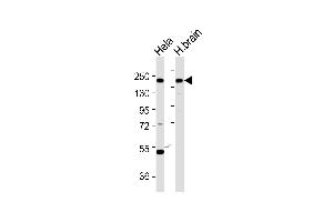 All lanes : Anti-YEATS2 Antibody at 1:1000 dilution Lane 1: HeLa whole cell lysates Lane 2: H.
