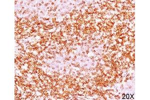 Formalin/paraffin human tonsil stained with CD6 antibody (3F7B5). (CD6 抗体)