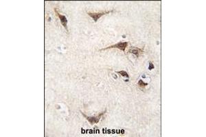 Formalin-fixed and paraffin-embedded human brain tissue reacted with SARS antibody (C-term) (ABIN392296 and ABIN2841952) , which was peroxidase-conjugated to the secondary antibody, followed by DAB staining. (Seryl-tRNA Synthetase (SARS) (AA 394-422), (C-Term) 抗体)