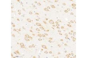 Immunohistochemistry analysis of paraffin-embedded rat brain using,VAMP4 (ABIN7076198) at dilution of 1: 3000 (VAMP4 抗体)