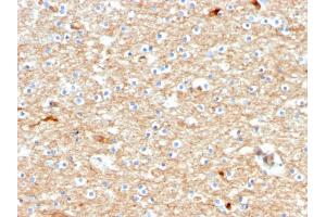 Formalin-fixed, paraffin-embedded human Brain stained with Drebrin-1 Mouse Monoclonal Antibody (DBN1/2880). (DBN1 抗体  (AA 150-281))