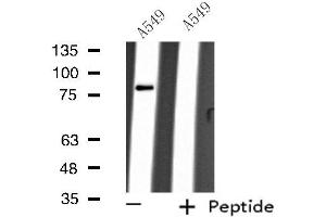 Western blot analysis of extracts from A549 cells, using ARHGEF16 antibody. (ARHGEF16 抗体  (Internal Region))