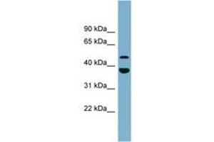 UFSP2 anticorps  (AA 395-444)