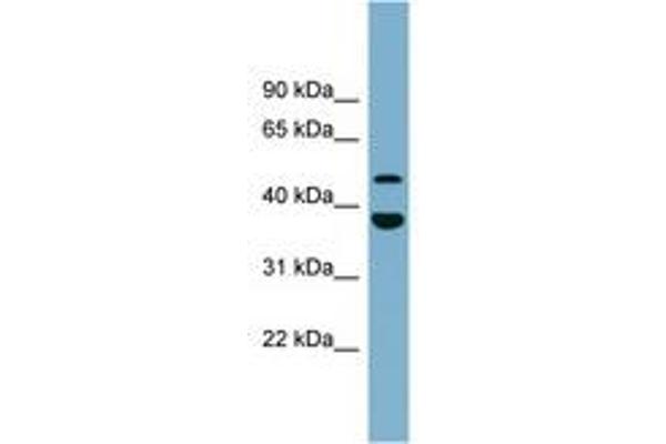 UFSP2 anticorps  (AA 395-444)