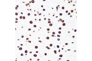 Immunohistochemistry (Paraffin-embedded Sections) (IHC (p)) image for anti-Histone 3 (H3) (H3K36me2) antibody (ABIN3016036)