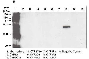 Western Blotting (WB) image for anti-Cytochrome P450, Family 3, Subfamily A, Polypeptide 5 (CYP3A5) (C-Term) antibody (ABIN307112)