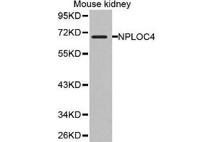 Western Blotting (WB) image for anti-Nuclear Protein Localization 4 Homolog (NPLOC4) (AA 1-270) antibody (ABIN1681086) (NPLOC4 抗体  (AA 1-270))