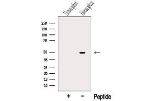 Western Blotting (WB) image for anti-serpin Peptidase Inhibitor, Clade A (Alpha-1 Antiproteinase, Antitrypsin), Member 5 (SERPINA5) (Internal Region) antibody (ABIN6258641)