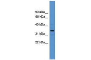 Image no. 1 for anti-Arginase, Type II (ARG2) (AA 71-120) antibody (ABIN6746383) (ARG2 抗体  (AA 71-120))