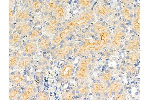 ABIN6258497 and ABIN6274436 at 1/100 staining Rat kidney tissue by IHC-P. (COQ8A 抗体  (Internal Region))