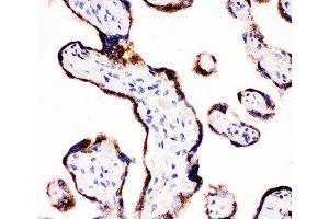 IHC-P: CYP11A1 antibody testing of human placenta tissue (CYP11A1 抗体  (C-Term))