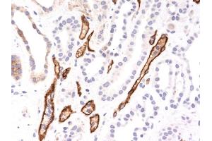 Formalin-fixed, paraffin-embedded human Kidney Transplant stained with Complement 4d Monoclonal Antibody (SPM545). (C4B 抗体)