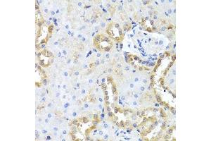 Immunohistochemistry of paraffin-embedded rat kidney using CGB7 antibody. (CGB7 抗体  (AA 21-165))