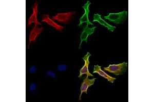 ABIN7094795 and ABIN7098846 staining Hela cells by IF/ICC. (HHIP 抗体  (C-Term))
