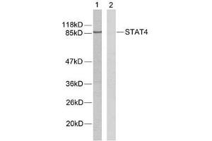 Western blot analysis of extracts from HeLa cells using STAT4 (Ab-693) antibody (E021047). (STAT4 抗体)