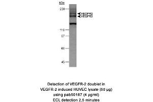 Image no. 1 for anti-VEGF Receptor 2 (VEGFR2) (AA 1200-1300), (Internal Region) antibody (ABIN363476) (VEGFR2/CD309 抗体  (Internal Region))