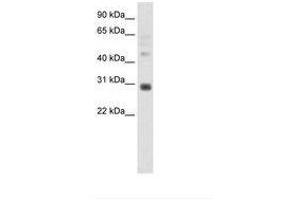 Image no. 1 for anti-Distal-Less Homeobox 5 (DLX5) (C-Term) antibody (ABIN202168)