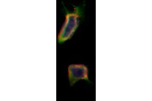 ABIN6257957 and ABIN6275973 staining Hela by IF/ICC. (BAI1 抗体  (Internal Region))