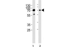 Western blot analysis of lysate from human 1) HeLa, and 2) Jurkat cell line using PAK3 antibody at 1:1000. (PAK3 抗体  (AA 124-152))