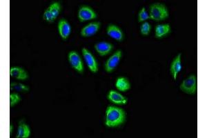 Immunofluorescent analysis of A549 cells using ABIN7153479 at dilution of 1:100 and Alexa Fluor 488-congugated AffiniPure Goat Anti-Rabbit IgG(H+L) (GABRA2 抗体  (AA 29-251))