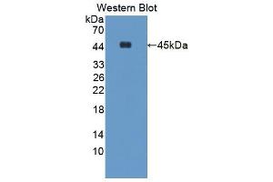 Western blot analysis of the recombinant protein. (ACAT1 抗体  (AA 31-424))