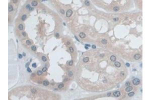 Detection of IDE in Human Kidney Tissue using Polyclonal Antibody to Insulin Degrading Enzyme (IDE) (IDE 抗体  (AA 753-973))