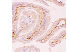 Immunohistochemistry (IHC) image for anti-Induced Myeloid Leukemia Cell Differentiation Protein Mcl-1 (MCL1) (AA 1-350) antibody (ABIN3043876)
