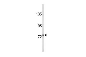 Western blot analysis of LTF Antibody (ABIN652643 and ABIN2842432) in MDA-M cell line lysates (35 μg/lane). (Lactoferrin 抗体)