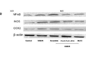 Western Blotting (WB) image for anti-Nitric Oxide Synthase 2, Inducible (NOS2) antibody (ABIN725675)
