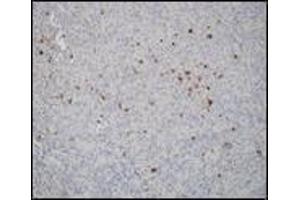 Immunohistochemistry (IHC) image for anti-Epstein-Barr Virus (EBV) (C-Term) antibody (ABIN870470) (EBV 抗体  (C-Term))