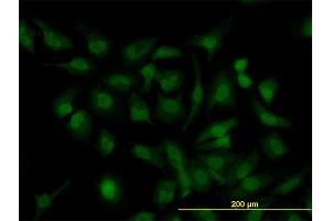 Immunofluorescence (IF) image for anti-Homeobox D11 (HOXD11) (AA 1-76) antibody (ABIN561349)