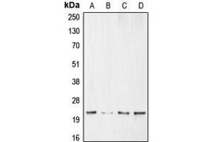 Western blot analysis of BNIP3 expression in HeLa (A), MCF7 (B), SHSY5Y (C), Ramos (D) whole cell lysates. (BNIP3 抗体  (Center))