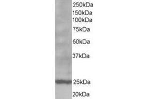 Image no. 1 for anti-B-Cell CLL/lymphoma 2 (BCL2) (N-Term) antibody (ABIN374455) (Bcl-2 抗体  (N-Term))