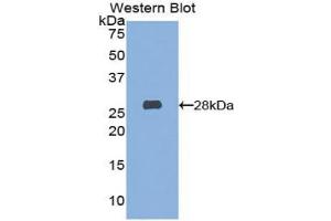 Detection of Recombinant HEXa, Mouse using Polyclonal Antibody to Hexosaminidase A Alpha (HEXa) (Hexosaminidase A 抗体  (AA 319-528))