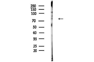 anti-Mitogen-Activated Protein Kinase 8 Interacting Protein 1 (MAPK8IP1) (pThr205) antibody