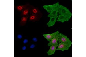 ABIN7093251 and ABIN7097268 staining H2O2 treated Hela cells by IF/ICC.