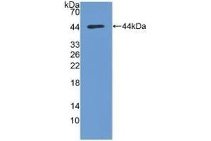 Detection of Recombinant PKBa, Human using Polyclonal Antibody to Protein Kinase B Alpha (PKBa) (AKT1 抗体  (AA 122-443))