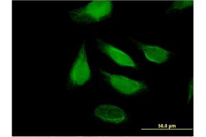 Immunofluorescence of monoclonal antibody to DIS3 on HeLa cell. (DIS3 抗体  (AA 861-956))