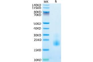 SDS-PAGE (SDS) image for T Cell Immunoreceptor with Ig and ITIM Domains (TIGIT) (AA 22-141) protein (His tag) (ABIN7275726)