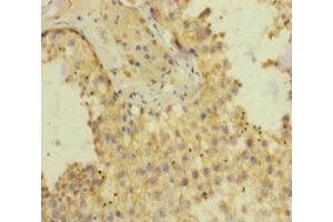 Immunohistochemistry of paraffin-embedded human testis tissue using ABIN7151643 at dilution of 1:100 (SH3GL3 抗体  (AA 1-270))